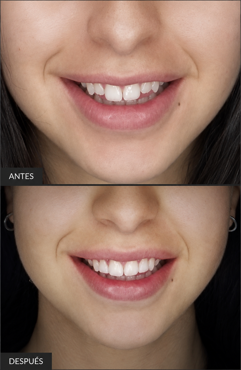 Caso odontología estética