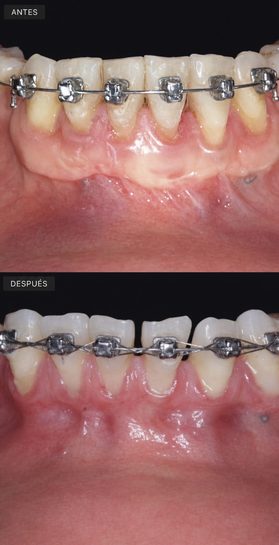Caso periodoncia